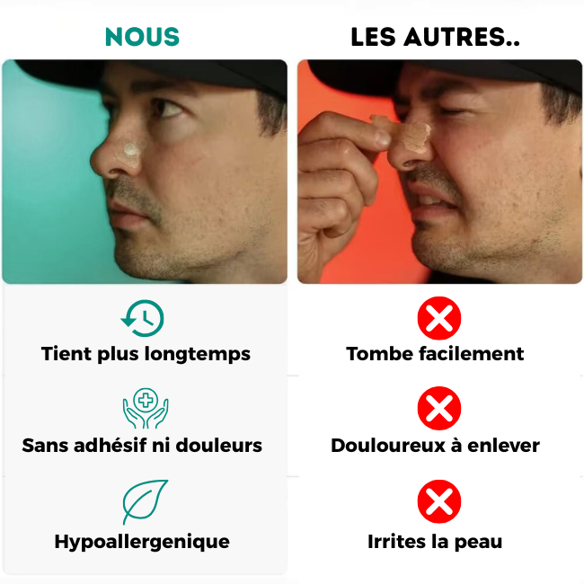 Bandes nasales Silentstrips