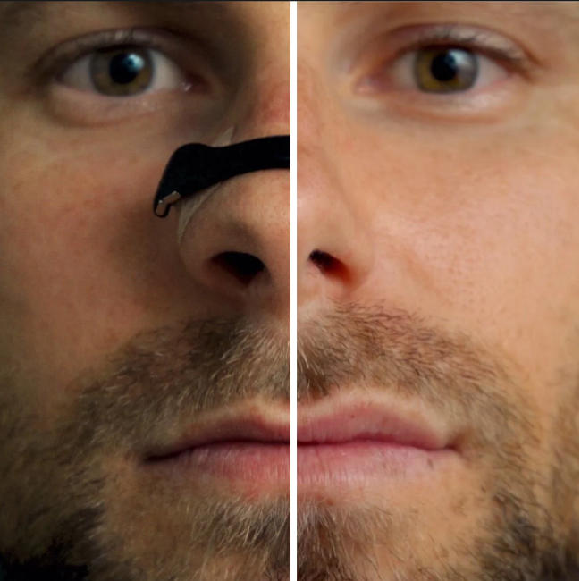 Bandes nasales Silentstrips
